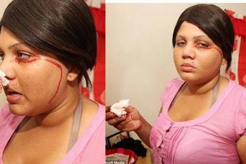 Lý giải đáng sợ chứng bệnh lạ 'đổ mồ hôi máu' khiến nhà khoa học đau đầu