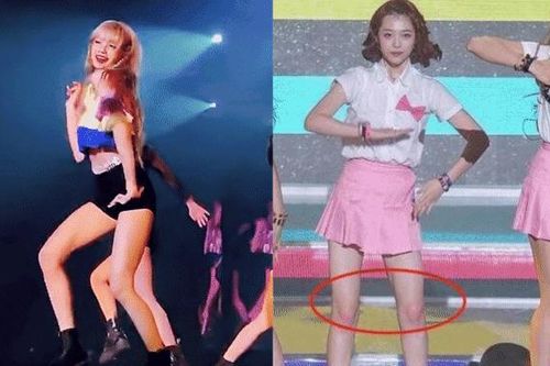 Đau lòng khi biết lý do các nữ idol Kpop thường đánh phấn hồng lên đầu gối