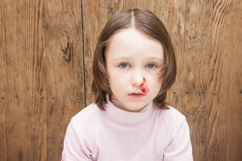 Mẹo ngừa chảy máu cam mùa lạnh cho trẻ