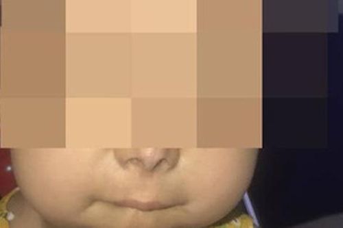 Bé 6 tuổi có nhiều bộ phận lão hóa như người già