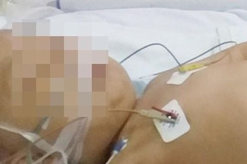Bé trai 4 tuổi ở Thanh Hóa mắc ung thư máu, hôn mê sâu đã qua đời dù được hỗ trợ và cứu chữa tận tình