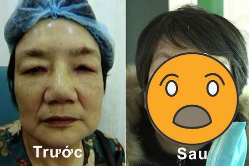 Chi 900 triệu đồng đi phẫu thuật thẩm mỹ, người phụ nữ bị chồng đuổi khỏi nhà vì tướng mạo dữ tợn