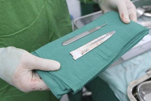 Cứu sống bệnh nhân bị đâm xuyên ruột sau 5 tiếng phẫu thuật
