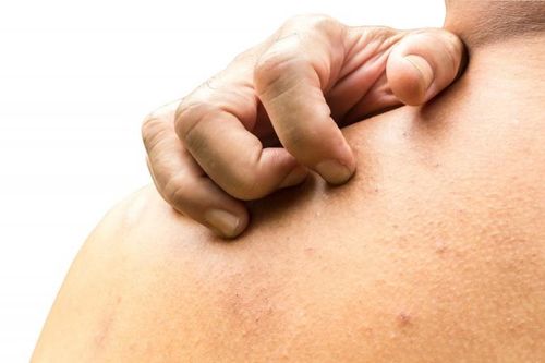 Hai người đàn ông ở TP.HCM bị hoang tưởng nhiễm ký sinh trùng