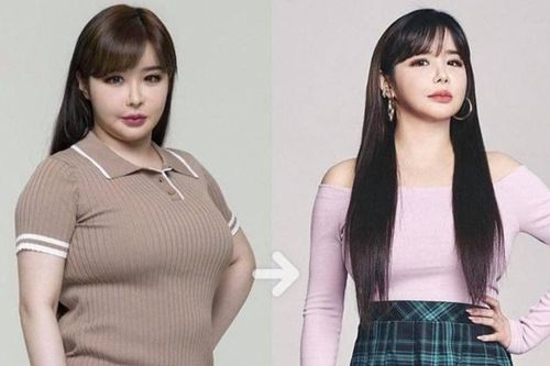 Park Bom và những sao Hàn giảm cân thành công