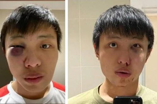 Thiếu niên Anh hầu tòa vì đánh du học sinh người châu Á