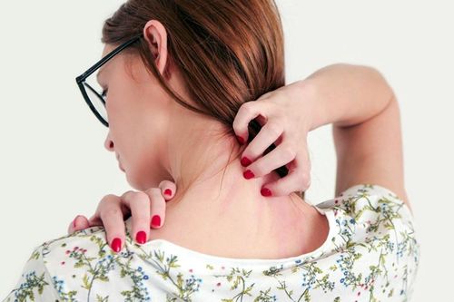 Căn bệnh khiến người mắc bị ám ảnh nhiễm ký sinh trùng