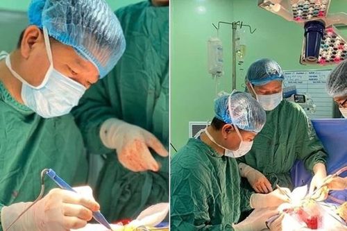 Đại phẫu khối u máu trong gan cho bé 14 ngày tuổi