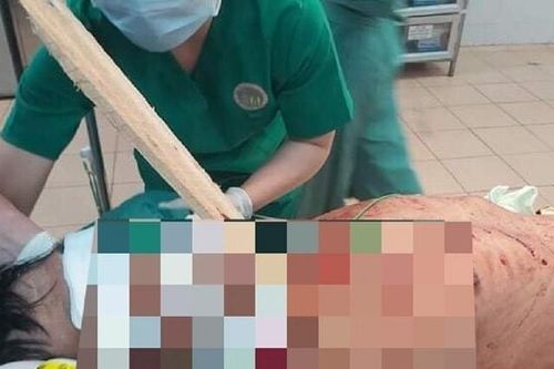 Cứu sống người đàn ông bị thanh gỗ đâm xuyên cổ