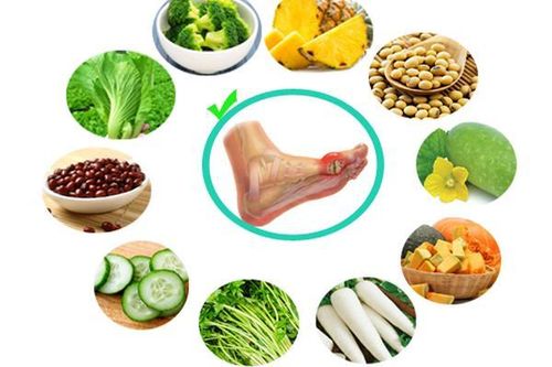 8 cách giảm axit uric không dùng thuốc
