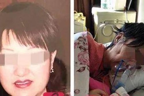 'Hot': Nữ doanh nhân hút mỡ thất bại trở thành người thực vật, mất sau 10 năm liệt giường