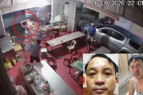 Công an vào cuộc vụ nhóm côn đồ vô cớ hành hung khiến người dân nhập viện