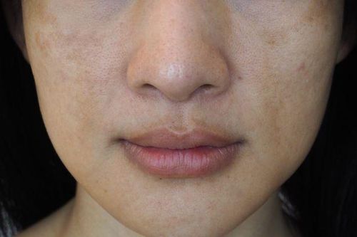 Dấu hiệu cảnh báo bạn đang thiếu vitamin C