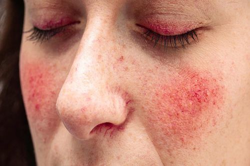 Những thay đổi trên khuôn mặt tiết lộ các vấn đề về sức khỏe