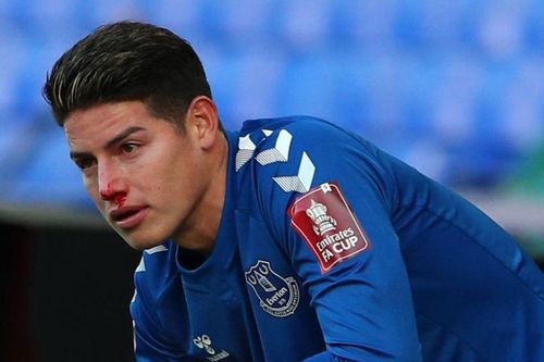 James Rodriguez đổ máu trong trận thắng của Everton