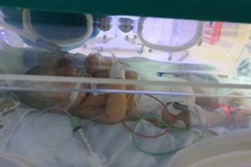 Bé 9 ngày tuổi nguy kịch do bị uốn ván