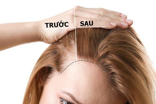 Kích thích tóc mọc nhanh bằng phương pháp tự nhiên