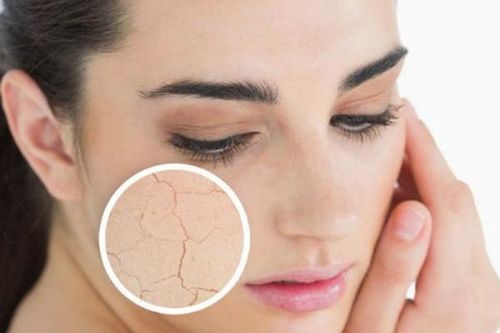 Trời lạnh, da khô dễ biến chứng