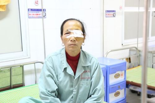 Người phụ nữ có mộng mắt che kín đồng tử