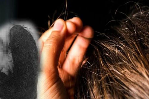 Căn bệnh khiến bé gái thích ăn tóc
