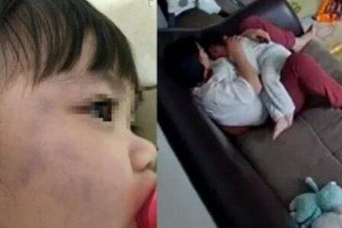 Thấy mặt con bầm tím, check camera bố mẹ sốc với hành động của giúp việc
