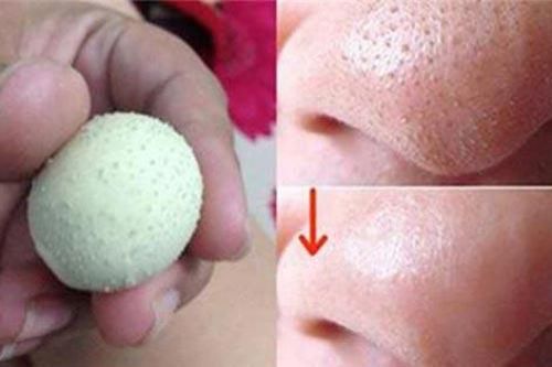 Sạch mụn đầu đen chỉ bằng cách dùng trứng gà