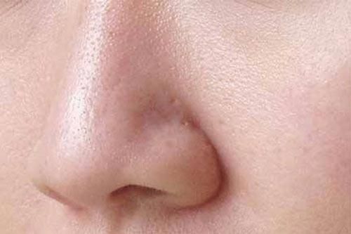 3 cách sẽ khít lỗ chân lông vô cùng hiệu quả