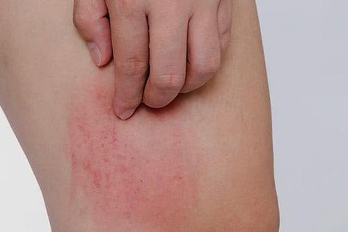 Ngứa 'như điên', tưởng ung thư hóa ra vì... hanh, lạnh