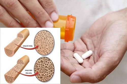Thuốc dễ gây loãng xương ở người cao tuổi