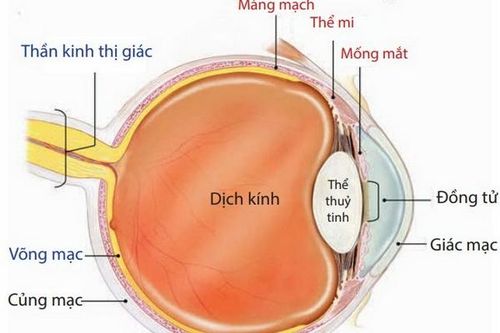 Viêm mống mắt có thể dẫn đến mù lòa