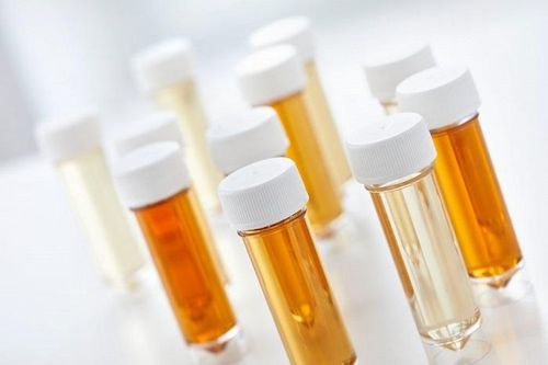 Thay đổi màu nước tiểu là dấu hiệu của bệnh lý nguy hiểm