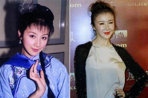 Những ngôi sao châu Á hóa thành 'thảm họa thẩm mỹ'