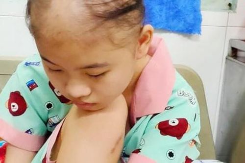 Xót xa hoàn cảnh nữ sinh lớp 8 bị ung thư xương đứng trước nguy cơ phải cắt chân