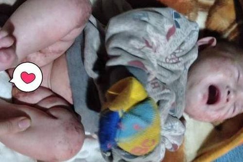 Xót xa bé gái toàn thân lở loét khóc ngằn ngặt trong ngày đông lạnh mà không tiền điều trị