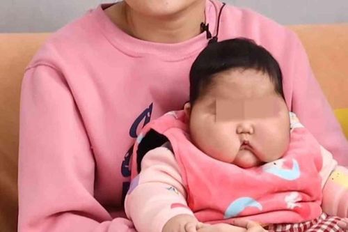Bé gái tại Trung Quốc phát triển bất thường sau khi dùng kem dưỡng da