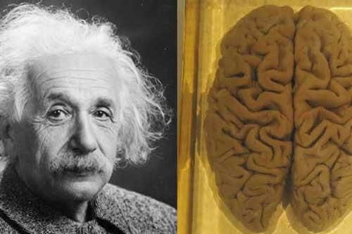 Cái chết của Albert Eistein và hành trình kỳ lạ của bộ não thiên tài