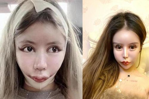 'Hotgirl thẩm mỹ' trải lòng chuyện dao kéo hơn 100 lần của bản thân khiến nhiều người bàng hoàng