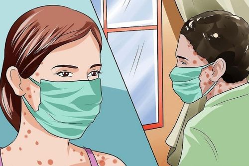 Bệnh nhân cần làm gì để phòng tránh lây nhiễm ra cộng đồng khi bị thủy đậu?