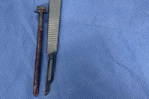 Người đàn ông bị bạn nhậu cắm đinh vít 6cm vào niệu đạo
