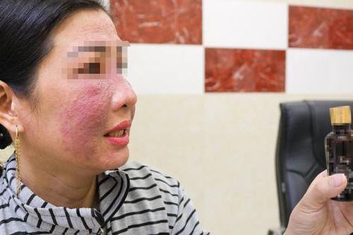 Rước họa vì dùng mỹ phẩm làm trắng da cấp tốc đón tết