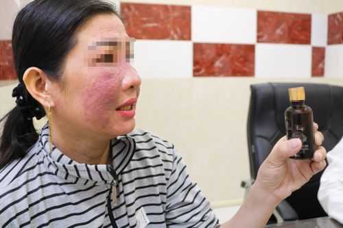 Hàng chục người nhập viện vì dùng mỹ phẩm làm trắng da cấp tốc