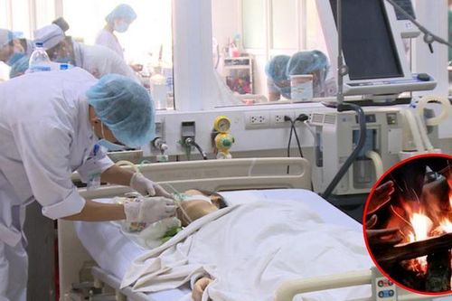 Xử trí và phòng ngộ độc khí than khi sưởi ấm