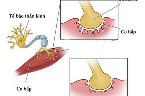 Cẩn trọng kẻo bị nhược cơ