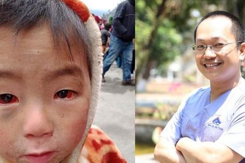 Tấm ảnh cháu bé miền núi phía Bắc 'bị xuất huyết dưới kết mạc' do thời tiết rét lạnh đỏ ngầu cả 2 mắt: BS chuyên khoa Mắt nói sự thật về nguyên nhân