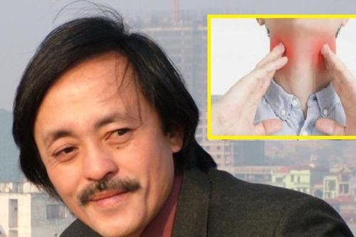 Dấu hiệu phát hiện sớm bệnh ung thư vòm họng nghệ sĩ Giang Còi đang mắc phải