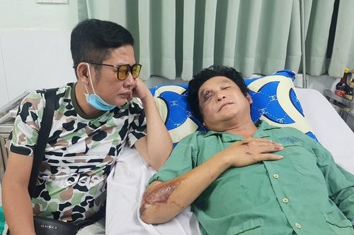 Nghệ sĩ Trọng Phúc gặp tai nạn, gãy xương má và vai