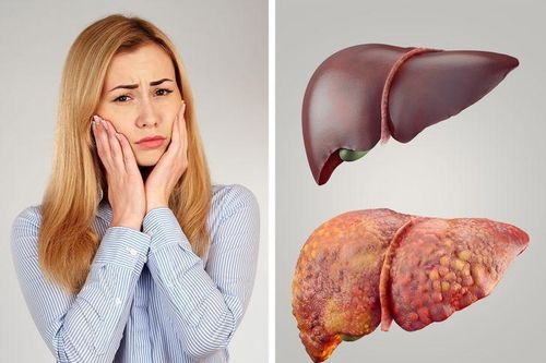 Những dấu hiệu cảnh báo cơ thể bạn cần phải giải độc