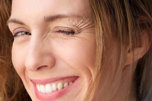 Nếp nhăn trên da xử lý không hề khó
