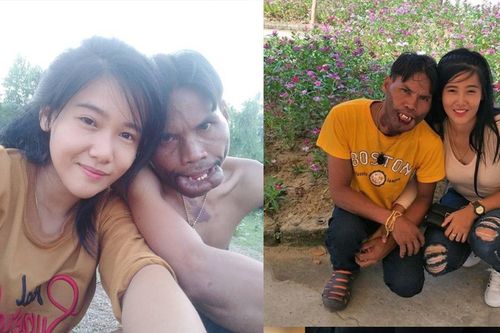 Cuộc hôn nhân không như mơ của chàng trai 'mặt quỷ' và 'vợ tiên'