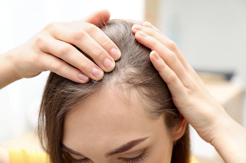 Vitamin ngăn ngừa rụng tóc